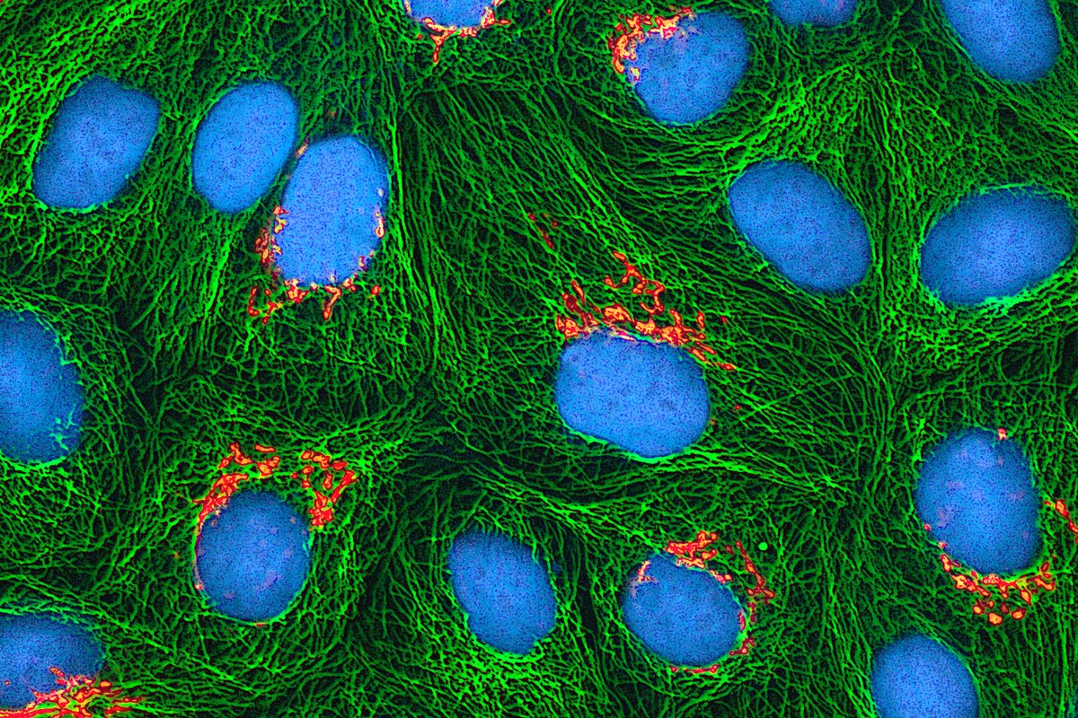 NMN and Aging: What Actually Happens to NAD+ As You Get Older — And Whether NMN Can Slow It Down