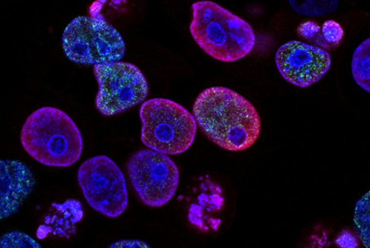 Spermidine: The Autophagy-Activating Longevity Compound